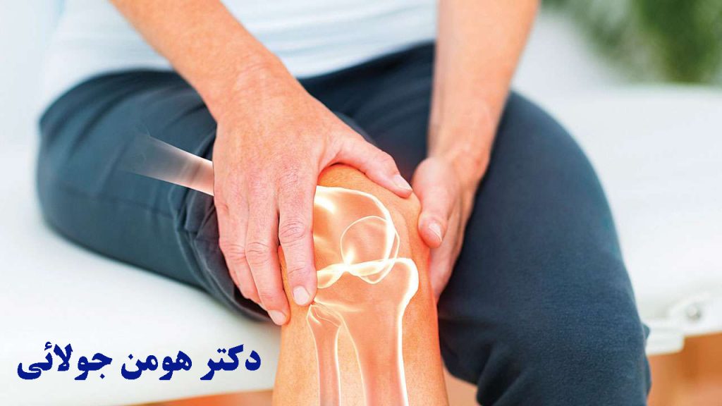 تعویض مفصل زانو