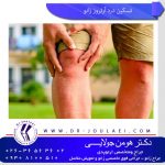 تسکین آرتروز زانو