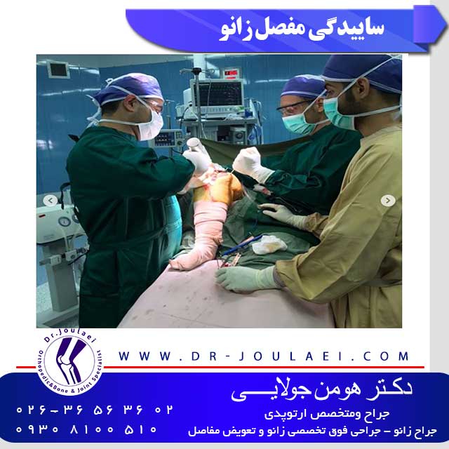 ساییدگی مفصل زانو - دکتر هومن جولایی